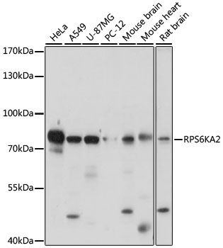Western blot