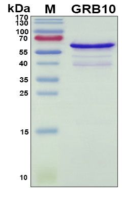 SDS-PAGE