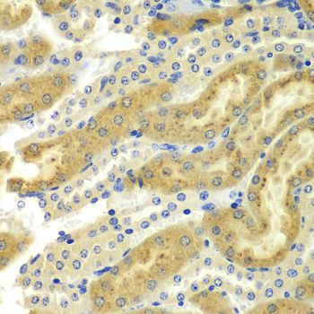 Immunohistochemistry - PAK2 Polyclonal Antibody (144-07333)