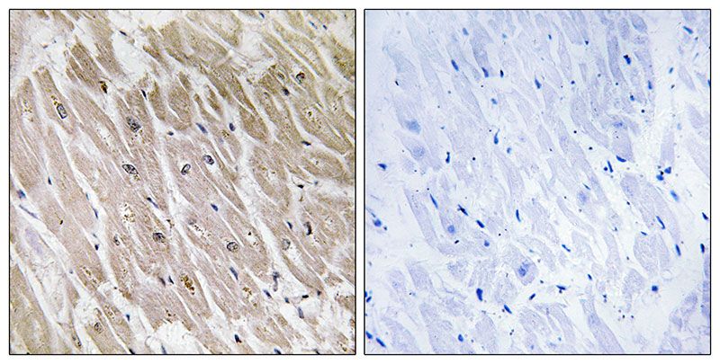 IHC