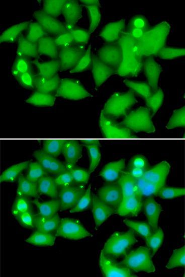 Immunofluorescence - UBASH3B antibody (144-07141)
