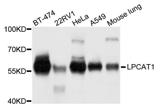 Western blot - LPCAT1 antibody (144-04987)