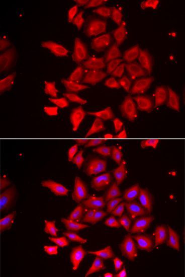 Immunofluorescence - TMOD4 antibody (144-06772)