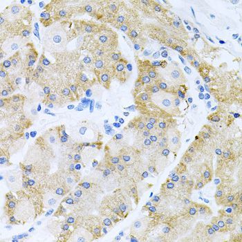 Immunohistochemistry - HDAC3 antibody (144-012542)