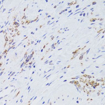 Immunohistochemistry - GATM Polyclonal Antibody (144-06598)
