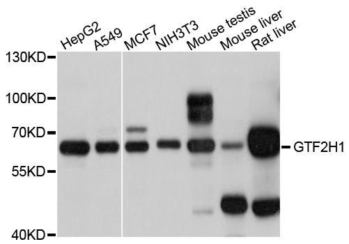 Western blot - GTF2H1 Polyclonal Antibody (144-06814)