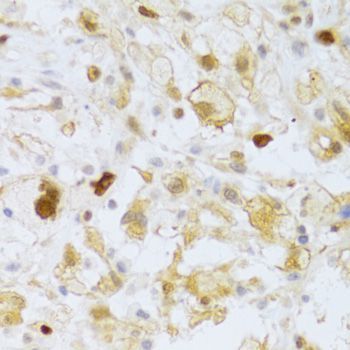 Immunohistochemistry - FCN1 Antibody (144-06587)