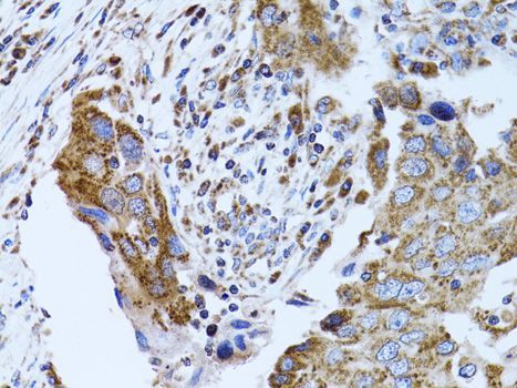 Immunohistochemistry - FABP4 Polyclonal Antibody (144-00232)