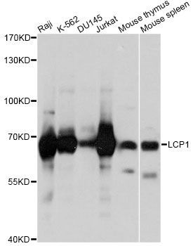 Western blot - LCP1 antibody (144-05561)