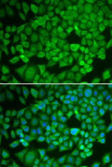 Immunofluorescence - NR0B1 antibody (144-01740)