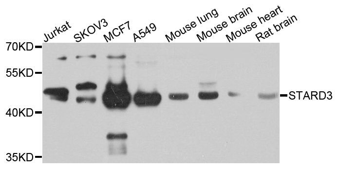 Western blot - STARD3 antibody (144-07776)