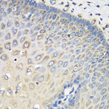 Immunohistochemistry - EEF1G antibody (144-07891)