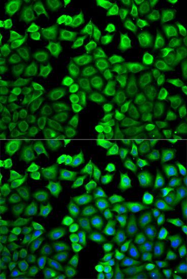 Immunofluorescence - HNMT antibody (144-02520)