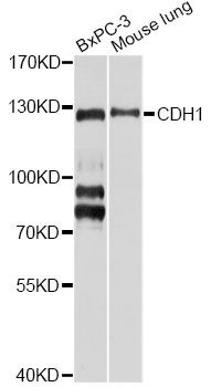 Western blot - CDH1 Polyclonal Antibody (144-03044)
