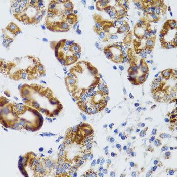 Immunohistochemistry - RIPK4 Polyclonal Antibody (144-08495)