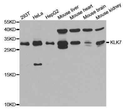 Western blot - KLK7 antibody (144-05506)