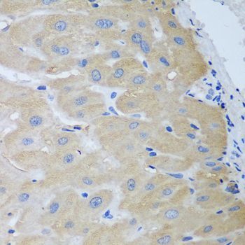 Immunohistochemistry - NME4 antibody (144-08350)
