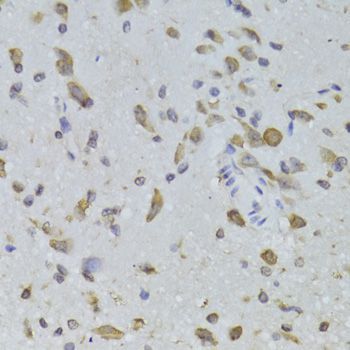 Immunohistochemistry - RPL13 Polyclonal Antibody (144-06723)