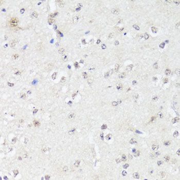 Immunohistochemistry - EGFR Polyclonal Antibody (144-011577)