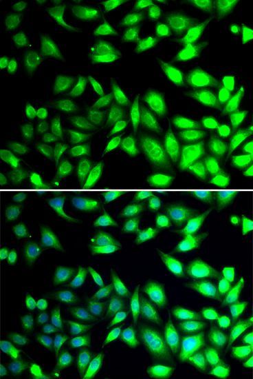 Immunofluorescence - PDIA6 antibody (144-07055)