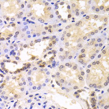 Immunohistochemistry - PSMC6 antibody (144-05377)