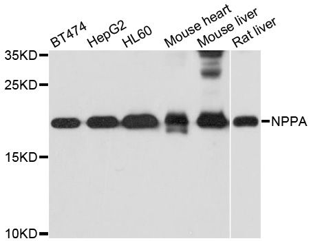 Western blot - NPPA Polyclonal Antibody (144-01609)