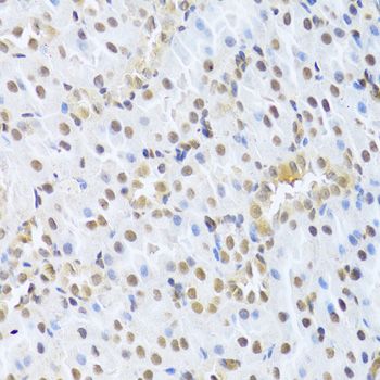 Immunohistochemistry - CDK4 Polyclonal Antibody (144-00366)