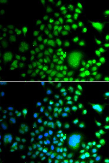 Immunofluorescence - PAX6 antibody (144-07334)