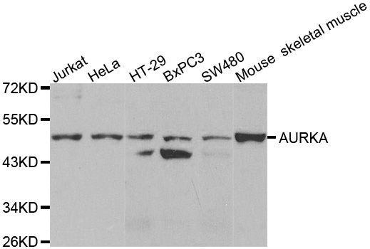 Western blot - AURKA antibody (144-02121)
