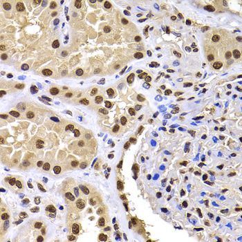 Immunohistochemistry - HIRIP3 antibody (144-07014)