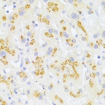 Immunohistochemistry - FAS Polyclonal Antibody (144-00233)