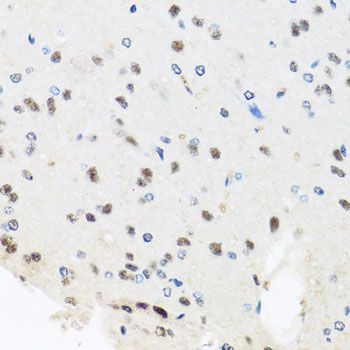 Immunohistochemistry - PRPF8 Polyclonal Antibody (144-06053)