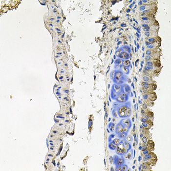 Immunohistochemistry - NDUFA6 antibody (144-09831)