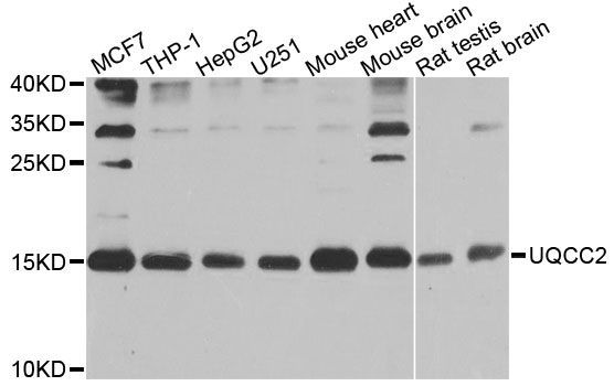 Western blot - UQCC2 antibody (144-09986)