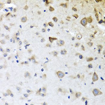 Immunohistochemistry - CPA6 antibody (144-60428)