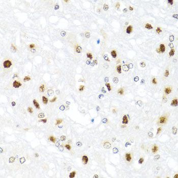 Immunohistochemistry - GATA2 Polyclonal Antibody (144-00677)