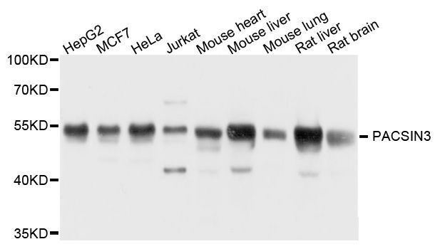 Western blot - PACSIN3 antibody (144-08647)