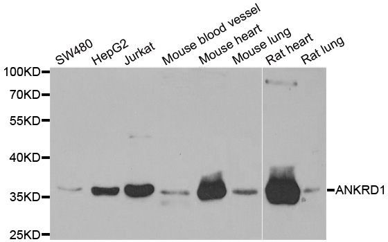 Western blot - ANKRD1 antibody (144-06192)