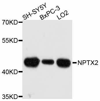 Western blot - NPTX2 antibody (144-012031)