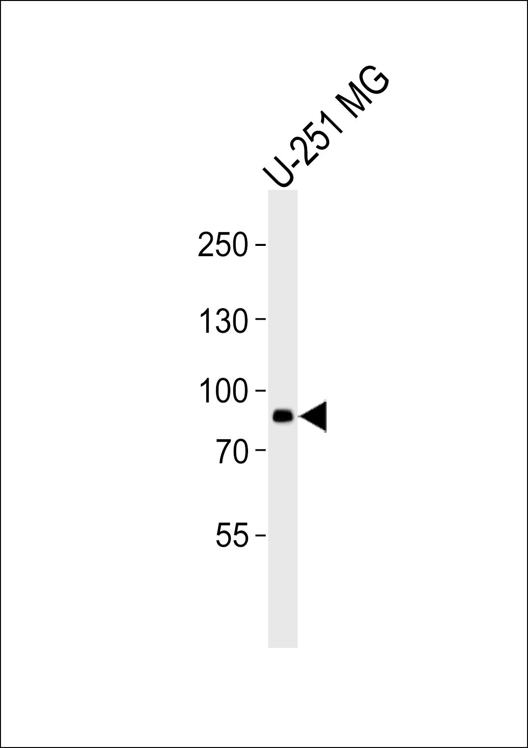 WB