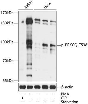 Western blot
