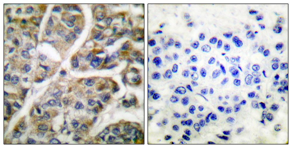 IHC