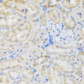 Immunohistochemistry - TIRAP antibody (144-12606)