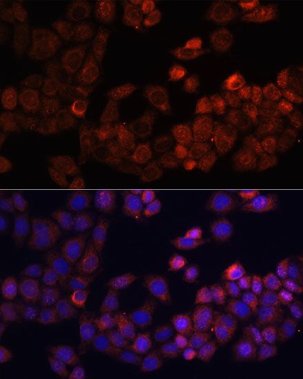 Immunofluorescence - PTK2 Polyclonal Antibody (144-60065)