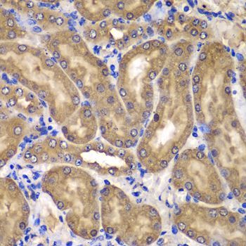 Immunohistochemistry - NME2 antibody (144-07443)