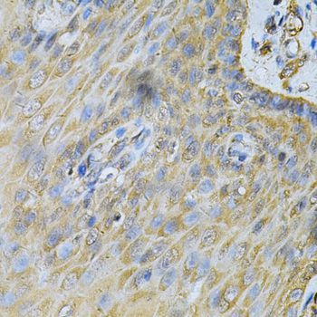 Immunohistochemistry - PDGFB Polyclonal Antibody (144-01195)