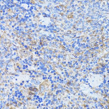 Immunohistochemistry - ARRB1 Polyclonal Antibody (144-00998)
