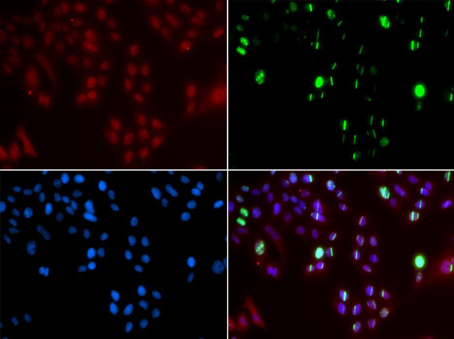 Immunofluorescence - FANCD2 Polyclonal Antibody (144-02072)