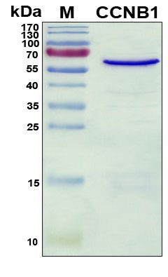 SDS-PAGE