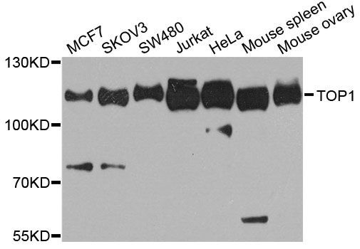 Western blot - TOP1 Polyclonal Antibody (144-12524)